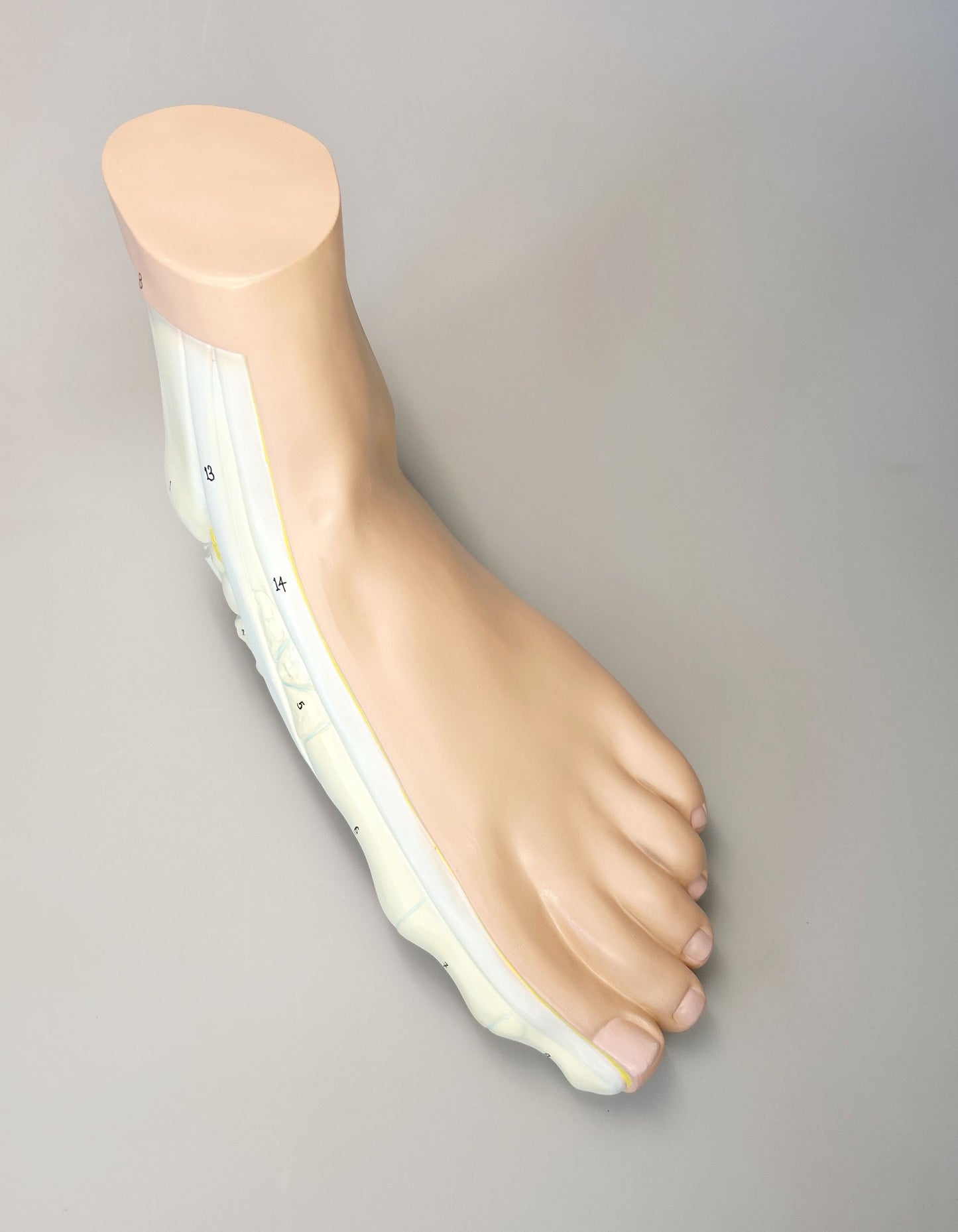 Model Plattfuß